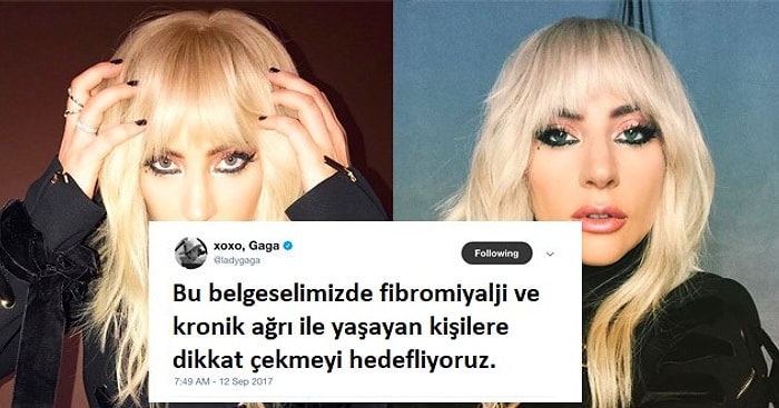 Büyük Geçmiş Olsun! Fibromiyalji Mağduru Lady Gaga Farkındalık Yaratmak İstiyor