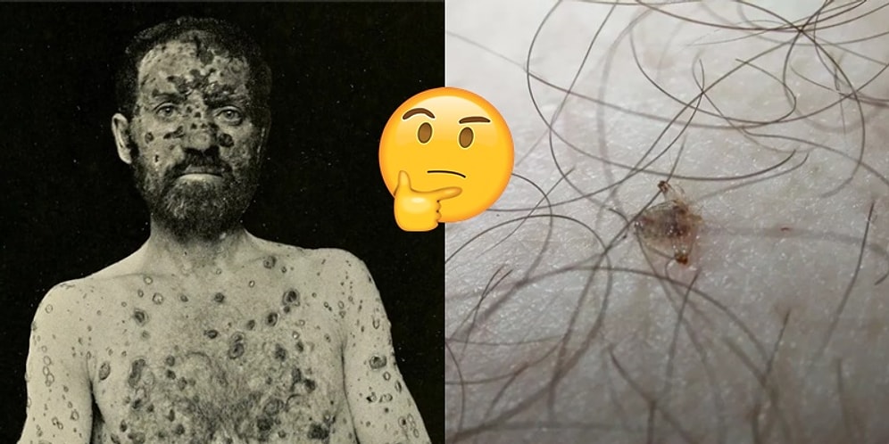 Cinsel Sağlık Uzmanlarının Üstüne Basa Basa Yanlışlığını Vurguladığı 19 Seks Klişesi