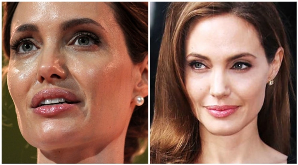 Yağlı Görünüme Son! Cilt Parlamasının Önüne Geçmek İçin Yapmanız Gereken 13 Şey