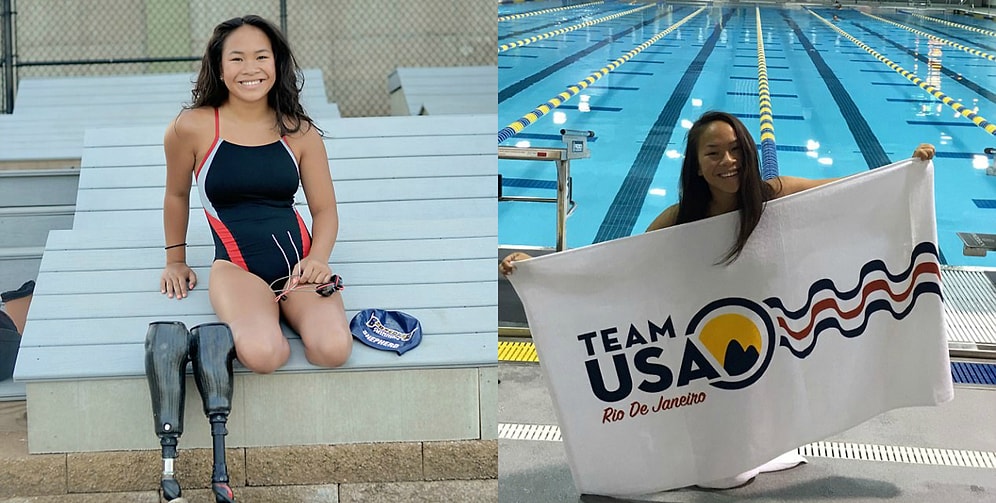 Девочка, потерявшая обе ноги в самоубийственном взрыве родителей, стала моделью