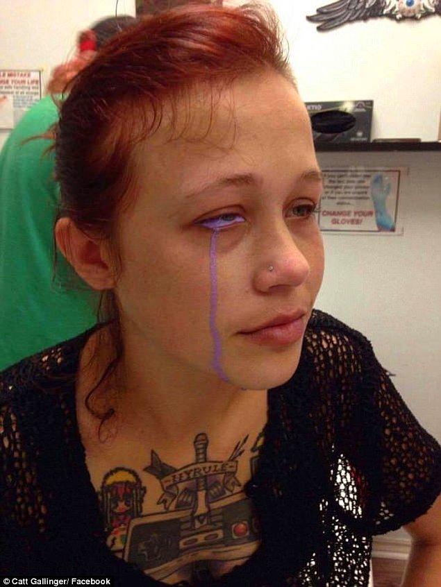 Büyük hata olarak nitelendirdiği dövme olayından sonra, tedavi olmaya başlayan kadın için doktorlar açıklaması ise, gözün düzelmesi neredeyse imkansız...