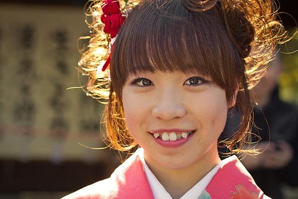 Japonlar da tam da bu sebepten, gençlik belirtisi olarak gördüklerinden bu dişleri beğeniyor.