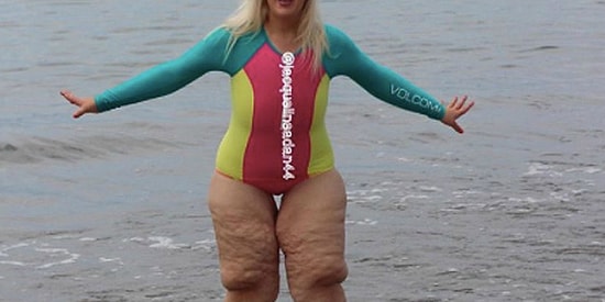 Похудевшую на 160 кг девушку обвинили в том, что у неё обвисшая кожа. Вот что она ответила...