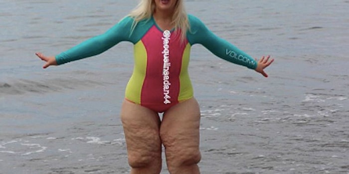 Похудевшую на 160 кг девушку обвинили в том, что у неё обвисшая кожа. Вот что она ответила...