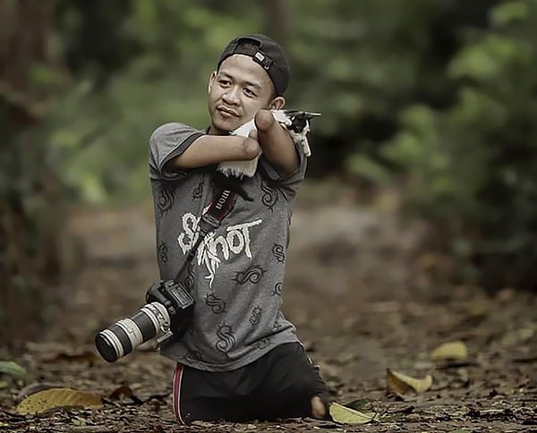 3. Ахмаду не хватает пальцев, но он научился использовать свое лицо, рот и дополнительную кожу на руках, чтобы управлять своим профессиональным фотоаппаратом.