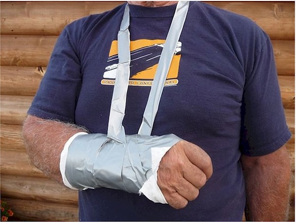 8. Изолента поможет поддержать сломанную руку..,