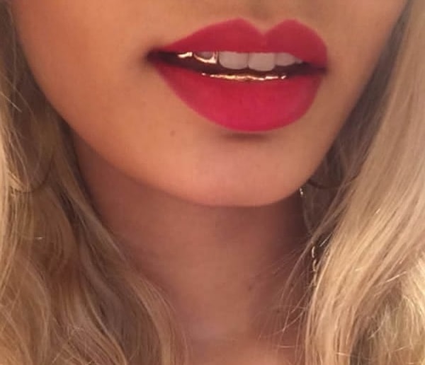 11. Бело-золотое сияние зубов... Они могут позволить себе и не такое