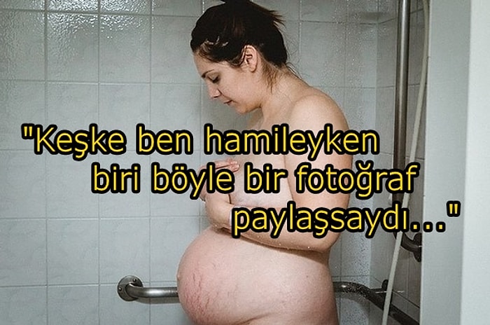 Bir Annenin Doğum Sonrası Vücudunu En Gerçekçi Şekilde Sergilediği Anlamlı Fotoğraf