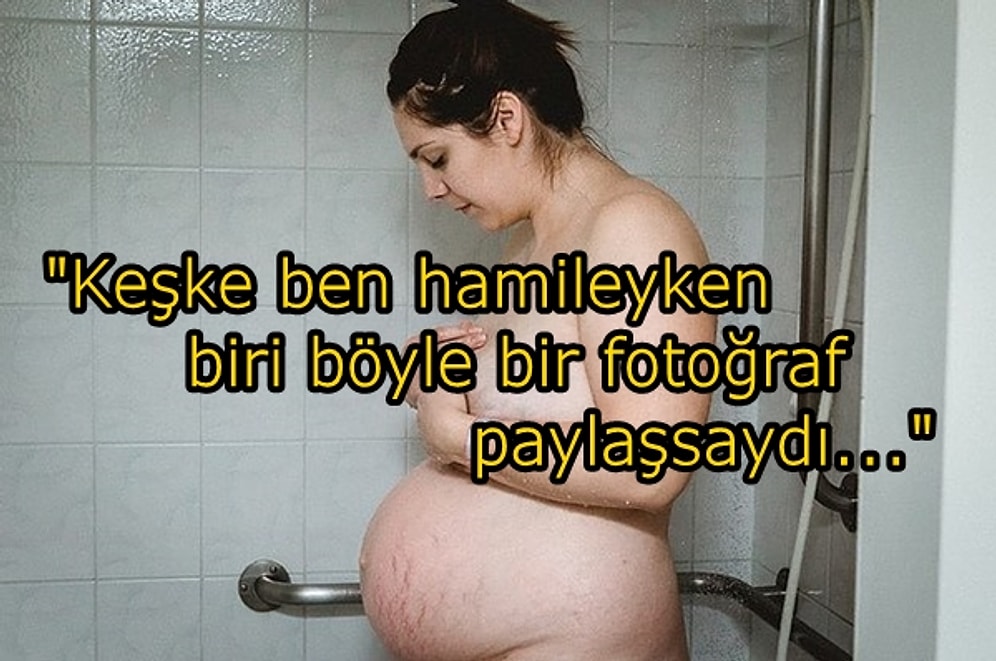 Bir Annenin Doğum Sonrası Vücudunu En Gerçekçi Şekilde Sergilediği Anlamlı Fotoğraf