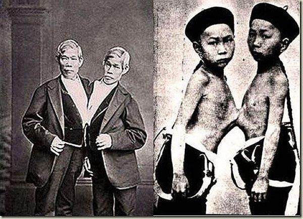 15. Tarihin ilk siyam ikizleri 1811'de Tayland'da doğmuştu.