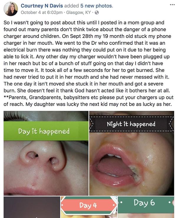 Kentuckyli bir anne, bebeğinin ağzı bir telefon şarjı yüzünden yanınca Facebook'ta insanları uyarmak için bir gönderi paylaştı.