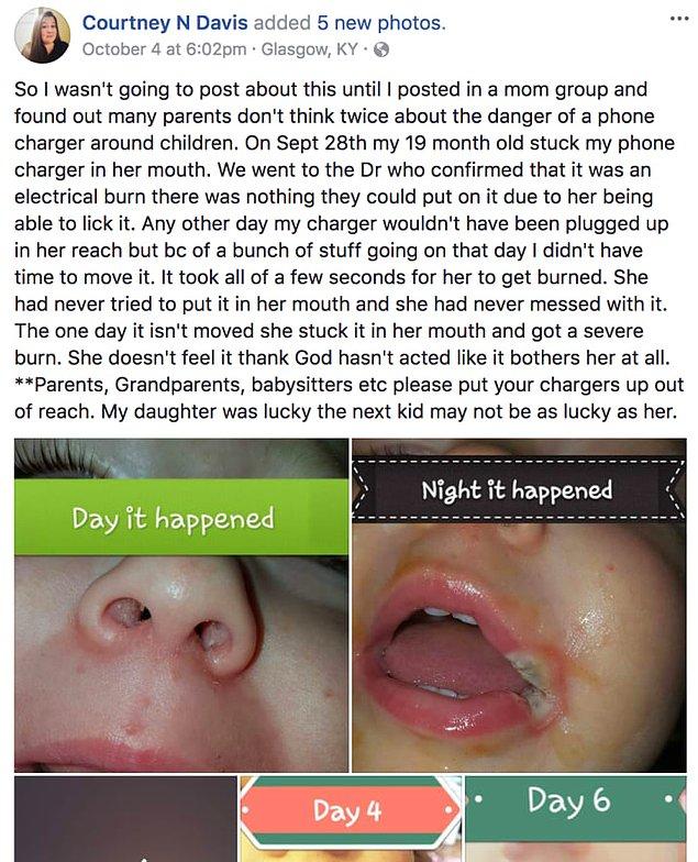 Kentuckyli bir anne, bebeğinin ağzı bir telefon şarjı yüzünden yanınca Facebook'ta insanları uyarmak için bir gönderi paylaştı.