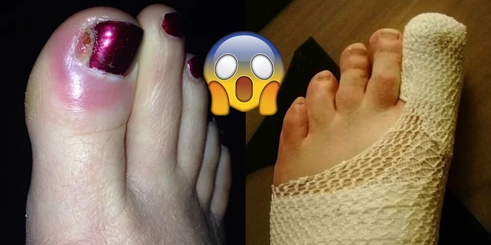 Hasta Gizliliği Bir Yere Kadar! Ayaklar Hakkında Doktorlardan Gelen 23 Tokat Gibi İtiraf