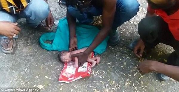 Hastane yetkilileri ise talihsiz bebeğin durumunun ciddi olduğunu belirtti. Bebek yalnızca 1.5 kilo kalmıştı.