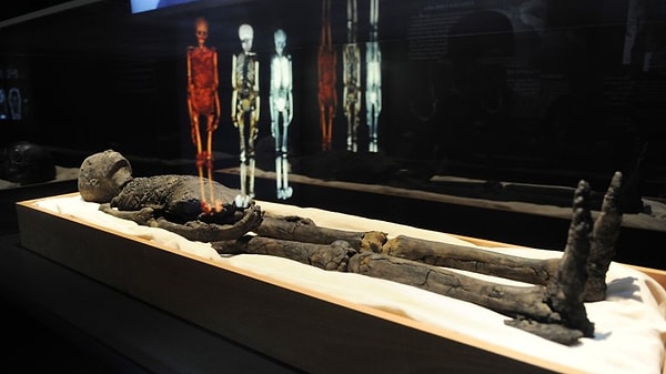 1. Как умер Тутанхамон?