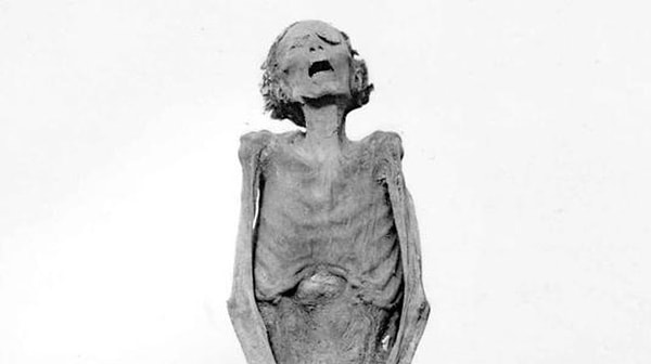 4. Почему у всех мумий раскрыт рот в крике?