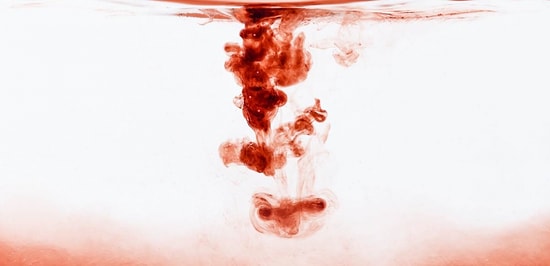 Редкий и страшный случай: итальянка на протяжении 3 лет потеет кровью