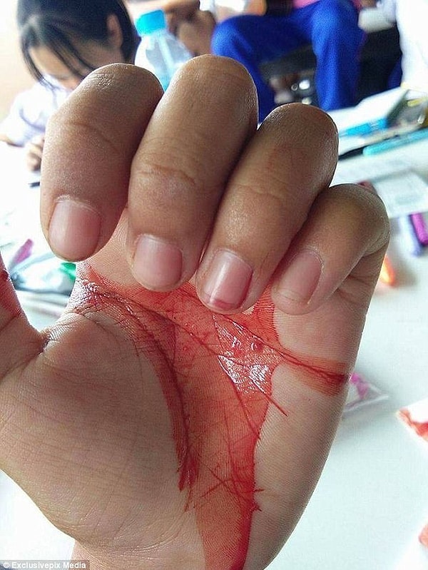 2. Она также утверждает, что кровотечение становится более обильным в стрессовых ситуациях и продолжается от одной минуты до пяти.