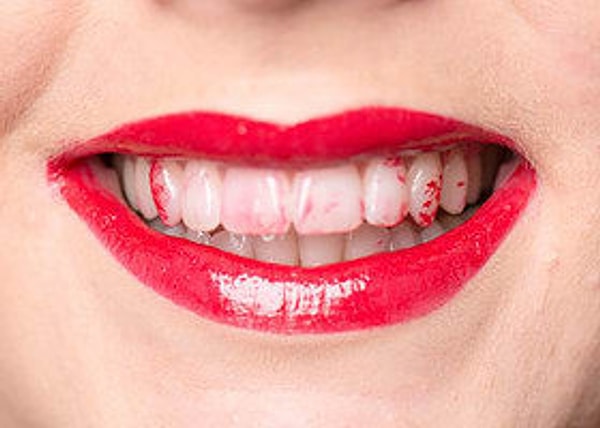 4. Вы просто улыбнулись, а тут такой нежданчик! 😡