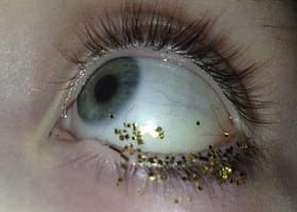 18. Неприятно, однако!