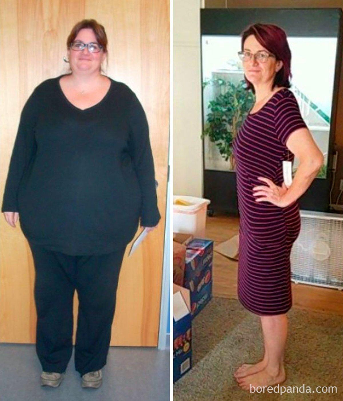Она сильно похудела. Похудение до и после. До и после похудения женщины. Полные до и после. Полные женщины до и после похудения.