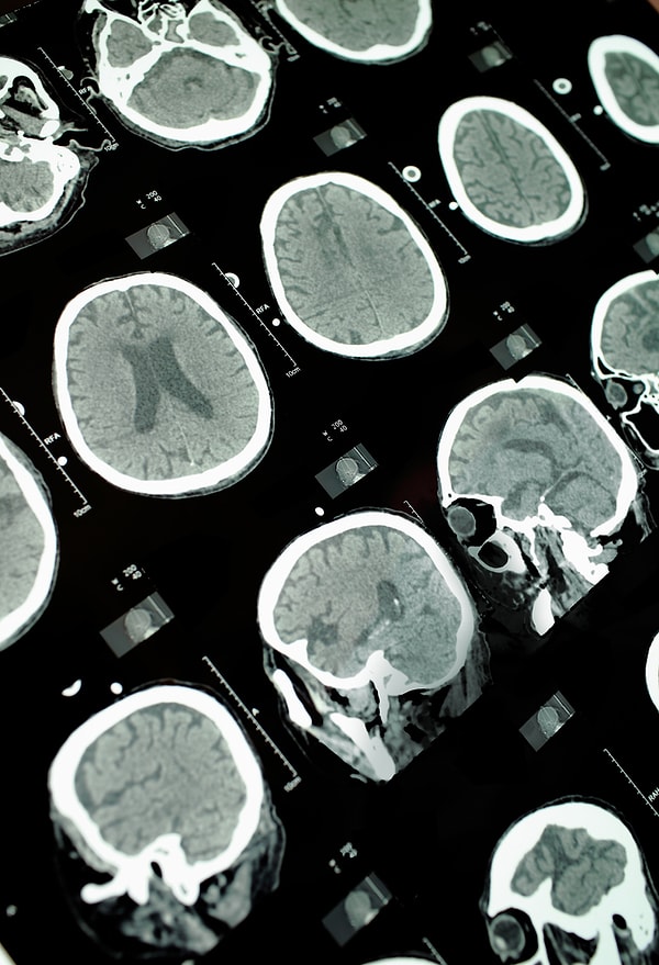 13. Каждую секунду мозг человека поглощает 11 миллионов единиц информации, однако запоминает всего лишь 40.