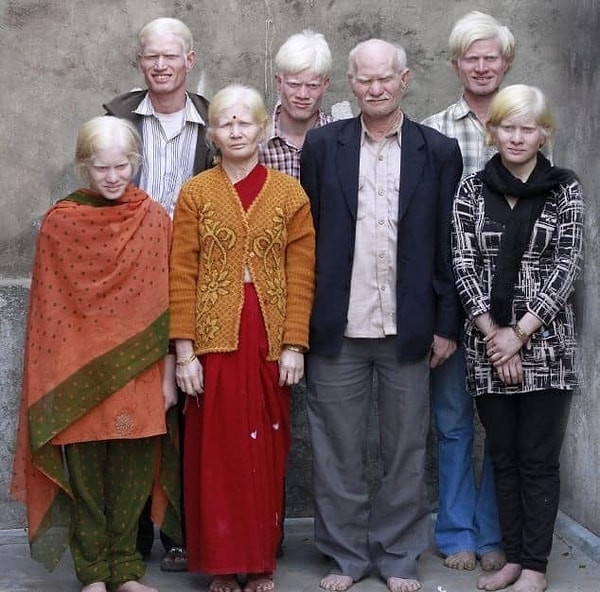 4. Необычная индийская семья, в которой рождается уже третье поколение альбиносов.