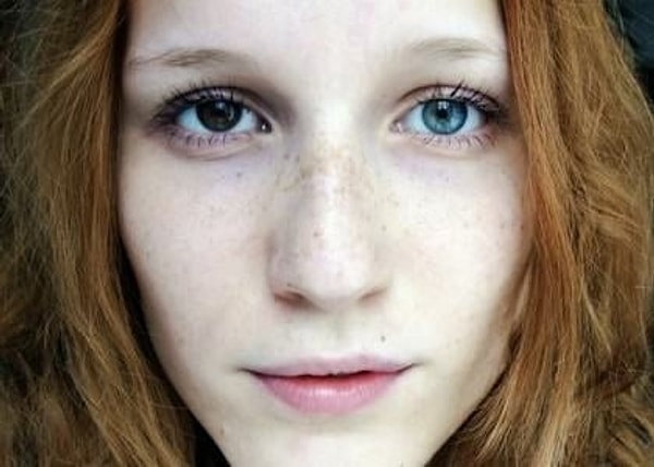 7. У этой девушки гетерохромия — различный цвет радужной оболочки правого и левого глаза.