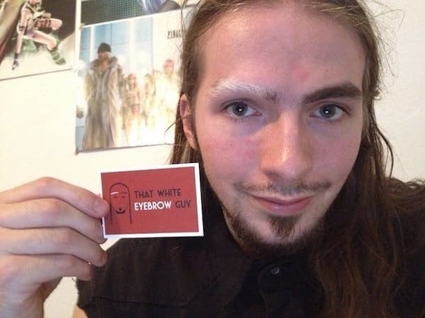 9. У этот парня редкое заболевание, которое называется «Синдром Ваарденбурга». Основные проявления этого синдрома включают в себя отличительные аномалии лица, необычную пигментацию волос, кожи или радужной оболочки обоих глаз и врождённую глухоту.