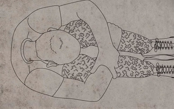 2. Однако после ранения у Марино возникли проблемы с памятью, головные боли, он утратил концентрацию внимания, и у мужчины начались панические атаки.