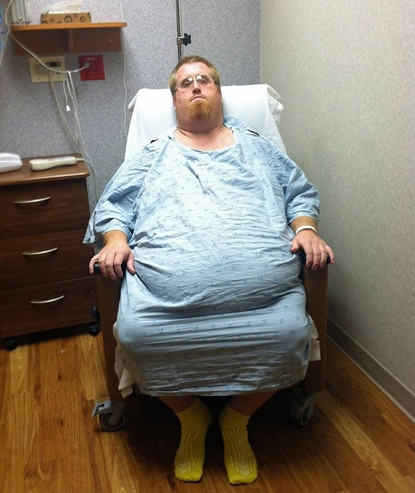 3. Но после этого вес Зака всё ещё оставался опасным, поэтому он решил пойти на операцию по шунтированию желудка.