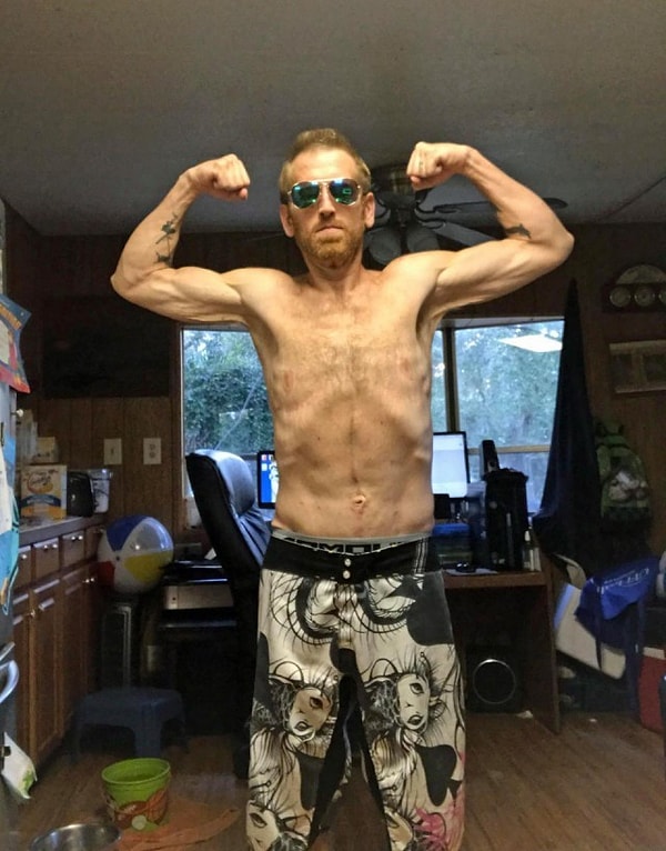 7. Затем Зак приступил к спортивным тренировкам, чтобы вернуть необходимый тонус своим мышцам и стать более здоровым.