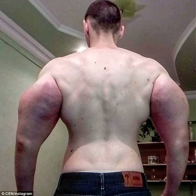 Kaslarını doğala en yakın şekilde, spor salonunda ve protein takviyeleriyle geliştiren sporcuların aksine Kirill tehlikeli bir kimyasal kullanıyor.