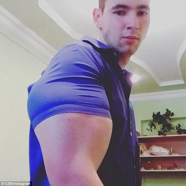 Kirill Tereshin spora vakit ayırsa da, kol çevresinin 50 cm'yi geçmesinin sebebi kasının içinde bulunan yabancı madde.
