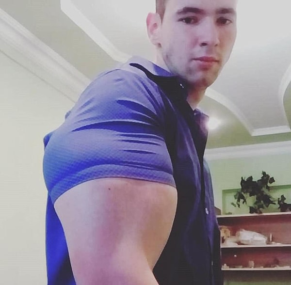 3. Поначалу Терешин вкалывал себе по 250 мл синтола, но его не устраивал результат, и парень стал колоть синтол литрами.