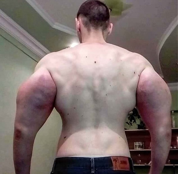 5. На некоторых фото заметно, что руки Кирилла имеют нездоровые красные пятна и синий оттенок.