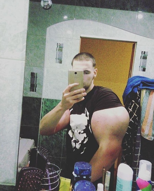 7. Питается «спортсмен» всего один раз в день и весит, не считая раздутых бицепсов (по 3,5 кг каждый), около 62 кг. Сложение у парня худощавое, так что смотрятся его «банки» довольно-таки карикатурно.