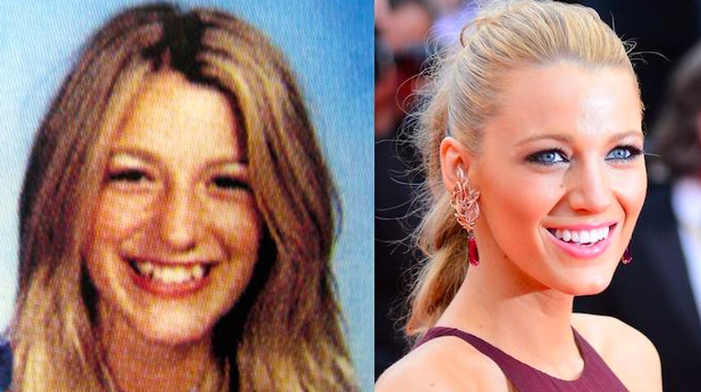 Из гадкого утёнка в лебедя: 25 звёзд, которые были страшненькими в школьные годы