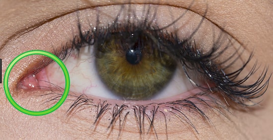 15 бесполезных частей тела, без которых человек вполне мог бы обойтись