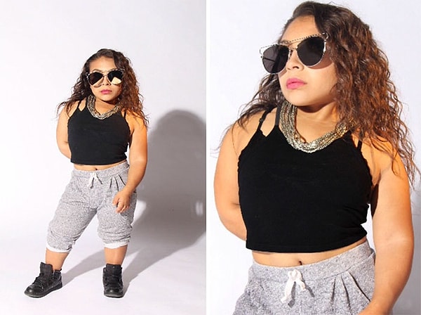 8. Она также хочет вдохновить людей с подобными проблемами следовать за своей мечтой.