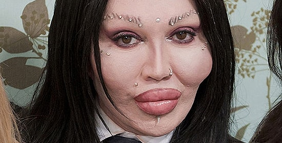 Не повторять на себе! 24 фото жертв пластической хирургии, на которых страшно смотреть