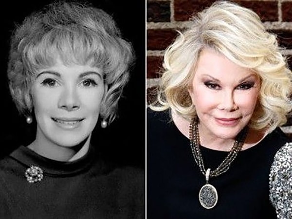 23. Джоан Риверз