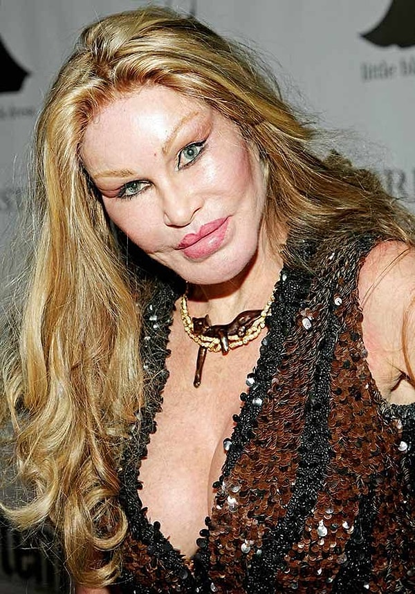 24. Джослин Вильденштейн