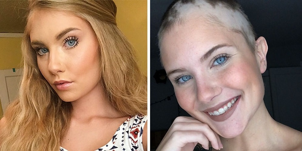 Трогательно: Мать украсила голову своей дочери, потерявшей волосы, цветами!