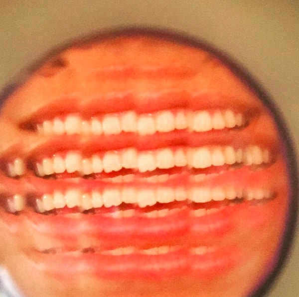 3. Такая вредная привычка может нанести большой вред вашим зубам: привести к их разрушению и болезням дёсен.