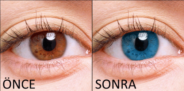 Göz Rengi Değiştirme Ameliyatından Sonra Yeni Moda Düşünce Gücüyle Göz Rengi Değiştirme: Biyokinezi