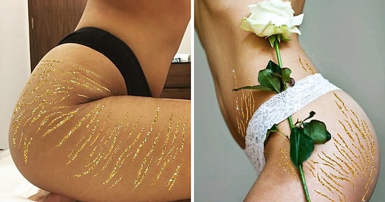 Искусство "кинцуги": почему пакистанская художница призывает женщин гордиться растяжками