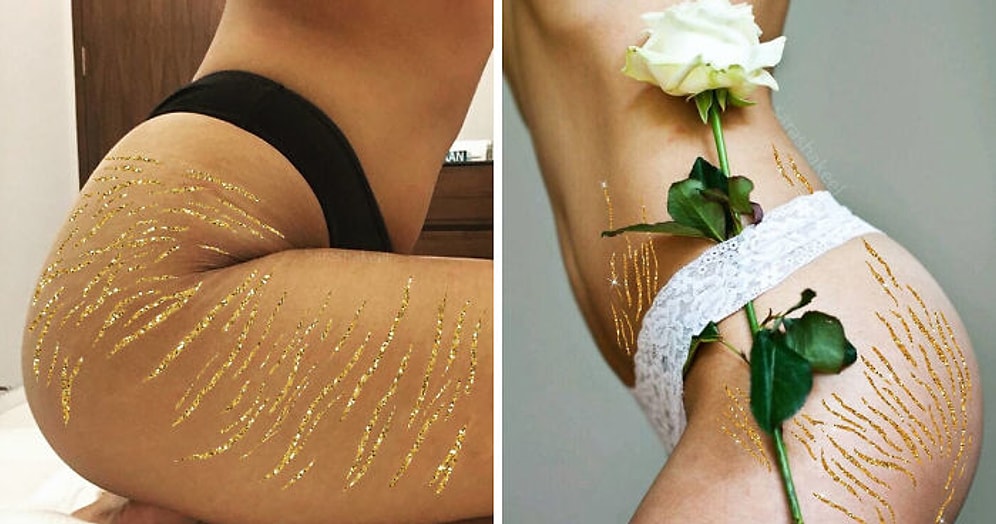 Искусство "кинцуги": почему пакистанская художница призывает женщин гордиться растяжками