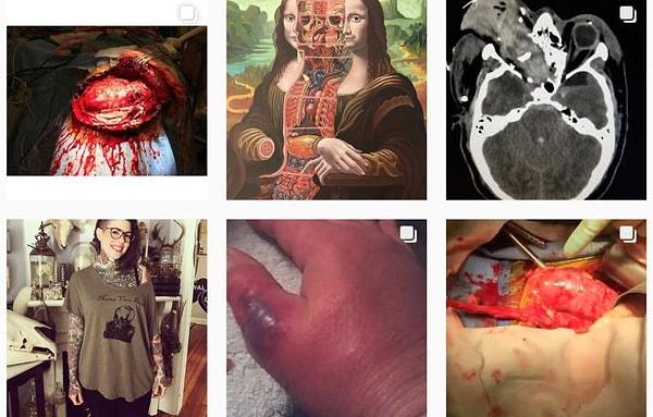 7. Bir patolog asistanı olarak görev yapan Nicole Angemi'nin organların incelenmesi, otopsi ve oldukça rahatsız edici yaralanmaları paylaştığı bir Instagram hesabı var.