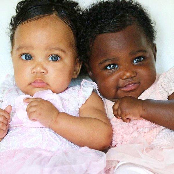 Fotoğrafları gören birçok kişi kızların anne babasının Afro ve beyaz olduğunu sanıyor.